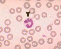 Patient has fever, leukopenia. What organism is this?