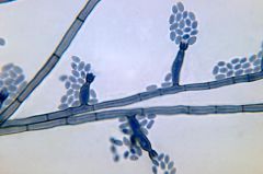 One of the three main types of sporulation of dematiaceous fungi that cause chromoblastomycosis. Looks like a flower.