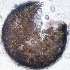 This demateaceous fungus can mimic aspergillus in tissue and in diseases caused (vasoinvasion).

what else can it mimic?