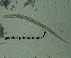 larvae of hookworm or strongyloides?
