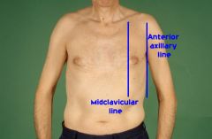 The midclavicular line bisects the center of each clav____ at a point halfway between the palpated sternoclavicular and acromioclavicular joints.