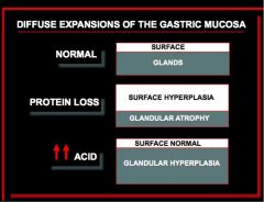 This is hypertorphic gastropathy.

H. pylori gastritis
 Ménétrier's disease - protein loss thus expansion of the surface
 Zollinger-Ellison syndrome - glandular hyperplasia so you get expansion of glandular area with normal surface