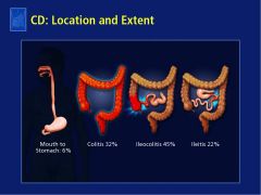 AREA: Most patients have involvement of R colon and terminal ileum.
Three phenotypes:  inflammatory, strictures, or penetrating/fistula Chron’s dz.

Patients with stricturing and fistulas tend to have more aggressive and advanced dz playouts.