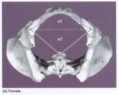 Urogenital triangle: ischial tuberosities and pubic symphysis
Anal triangle: ischial tuberosities and coccyx