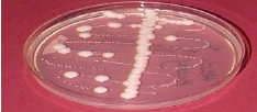 Name: E. coli
EMB: Green
Blood Agar: Alpha Hemolysis
SAB: Pinpoint Colonies