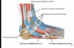 Pernoneal retinaculum- calcaneus to lateral malleolus 

Inferior extensor retinaculum-starts at calcaneous and wraps over the top of the foot