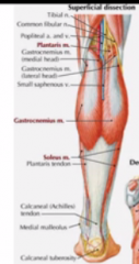 the gastrocnemius muscle

aka the calcaneal tendon