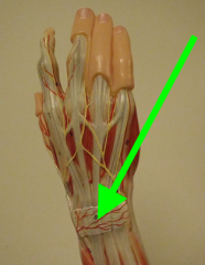 holds the extensor tendons close to the wrist