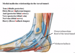 the FLEXOR retinaculum (cause it holds all the flexor tendons back!