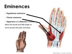 the mass on the medial/ulnar side of the palm