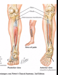The tibialis muscles start to pull away from the interosseous membrane from overuse and this leads to inflammation.
