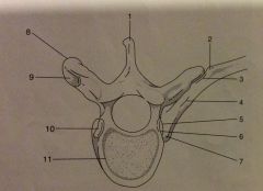 In fig 2-27, the structure indicated as # 7 is which of the following
A. Neck of rib
B. Tubercle of rib
C. Transverse process
D. Head of rib