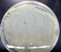 What was the result of the LB with E.coli & water? 