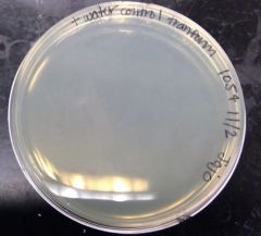 What was the result of LB + Amp + X-gal with E.coli and water? 