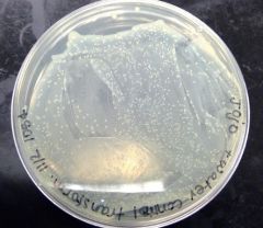 What was the result of LB and E.coli with plasmid? 