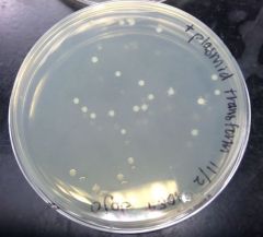 What was the result of LB + Amp + X-gal with E.coli and plasmid? 