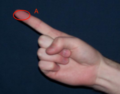the anterior, distal end of the finger