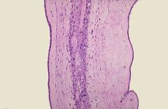  Placenta