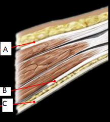 What are the layer of the anterior abdominal wall?