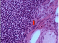 The arrow on the slide is pointing to a ganglionic cell body of Meissner’s plexus within the submucosa.