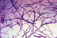 gram positive, anthrax, chains of rods, bracteria
