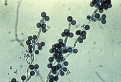 yeast infections, lives inmucosal membranes fungus