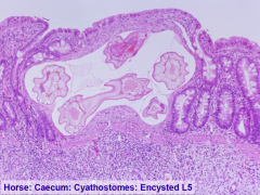 Cyathostomosis (horses)
Small strongyles. 
Larval development in nodules in mucosa/submucosa
Diarrhoea
Infiltration by eosinophils, neutrophils, macrophages
Oedema
Mucosal ulceratoin