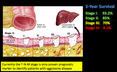 Extent of the tumor (stage) at the time of diagnosis