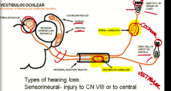 Cohlear- spiral ganglion
Vestibular- vestibular ganglion

both before the IAM