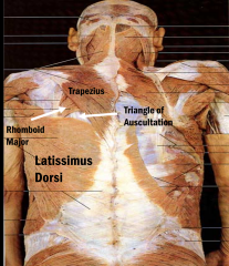 -trapezius
-latissimus dorsi
-rhomboid major