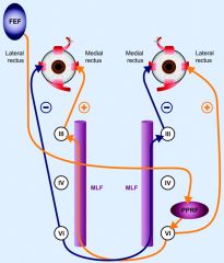 Follow the orange line for what is activated

1. initiate plan in left visual eye field
2. send UMN fibers down to right paramedian pontine reticular formation (PPRF) - push button
3. PPRF sends UMN's to the CN 6 right next to it and to the le...