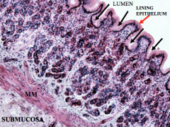 Here, can see the simple columnar epithelium making up the lining epithelium. Below is the submucosa- recall that there are NO glands in this layer.