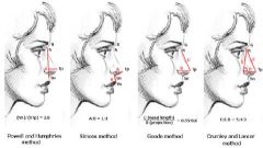 A: Powell & Humphreys – Height measured from Nasion to Subnasale, perpendicular drawn through Tip defining point, ratio of N-X/X-Tp ideally 2.8:1A: Goode – line drawn from the alar-facial groove to the nasal tip measures 0.55-0.60 of the dista...