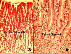 Cardiac region vs. pyloric region of stomach