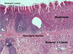 Really great picture of the duodenum