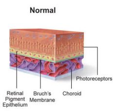 outer layer of retina consisting of epithelium called the pigment epithelium

regular nutrients plus vitamin A!