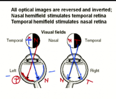 the nasal retina