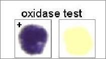 What is the name of this test?
What does it test for?