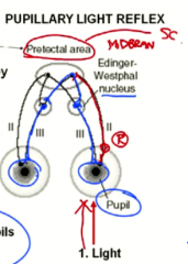 1. light in one eye
2. travels via CN 2 to the pretectal area
3. pretectal area bilaterally innervated nucleus of edinger westphal
4. both pupils constrict