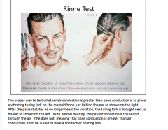 Review the Rinne test.