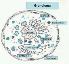 Granuloma (def.)