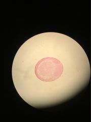 Clade
Phylum 
subphylum
class
name
proto or deutero
