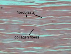 Lots of fibers


 


Fibrous - tendons/ligaments (regular), skin (irregular)


 


Elastic - aorta, head/neck


 


Cartilege/Bone - next lecture


 


 