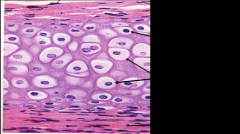 a cell that has secreted the matrix of cartilage and become embedded in it