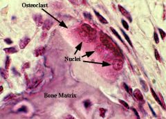 a large multinucleate bone cell that absorbs bone tissue during growth and healing