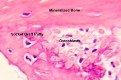 a cell that actively synthesizes and secretes the matrix for bone formation


 


Euchromatic nuclei and a lot ER


 


Found on the surface of the bone