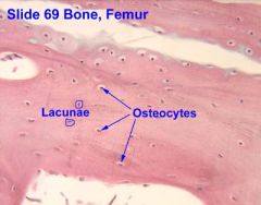 a bone cell, formed when an osteoblast becomes embedded in the matrix it has secreted