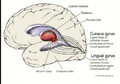 cuneus- goes through a direct path in the parietal lobe

lingual- goes through path in temporal lobe with a tight hairpin turn called "meyer's loop"