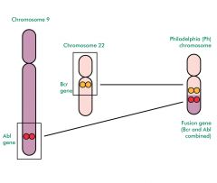 Formation of philadelphia chromosomes by a reciprocal translation of the q arms - creation of oncogenic BCR-ABL fusion gene .