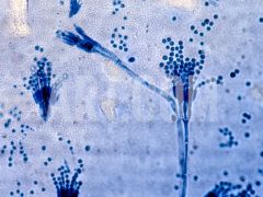 Name this image in a
Lactophenol blue stain